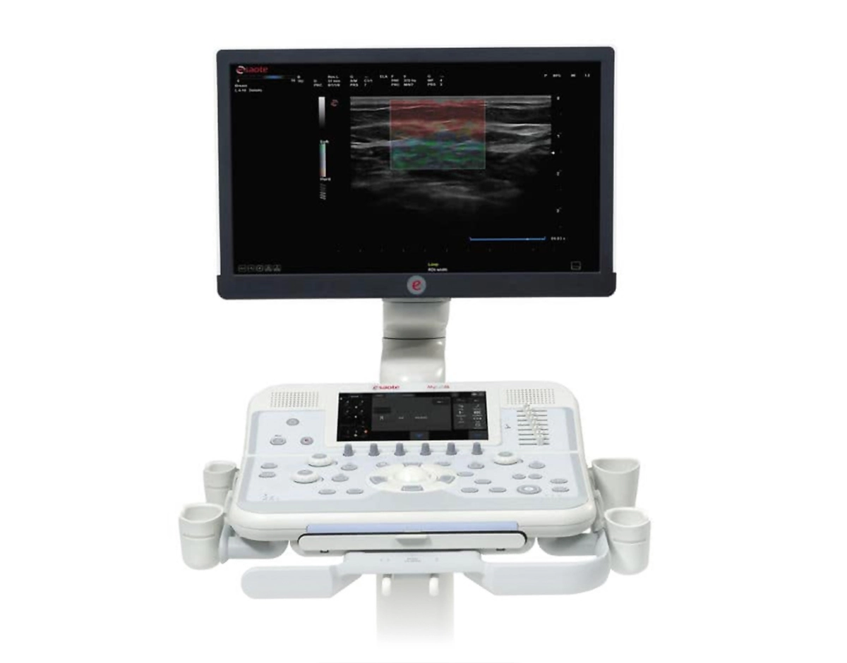 TROCA DE CRISTAIS ULTRASSOM ESAOTE MYLAB X6